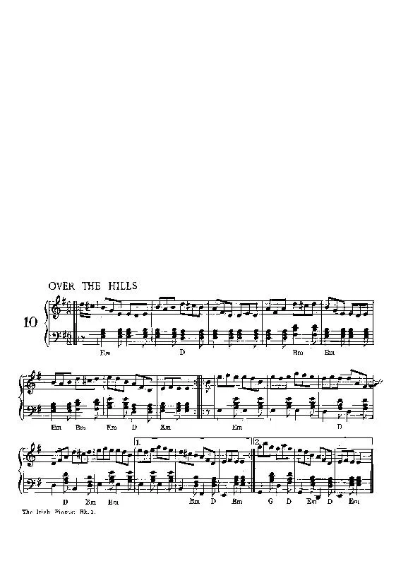 télécharger la partition d'accordéon Over the Hills (Gigue) au format PDF